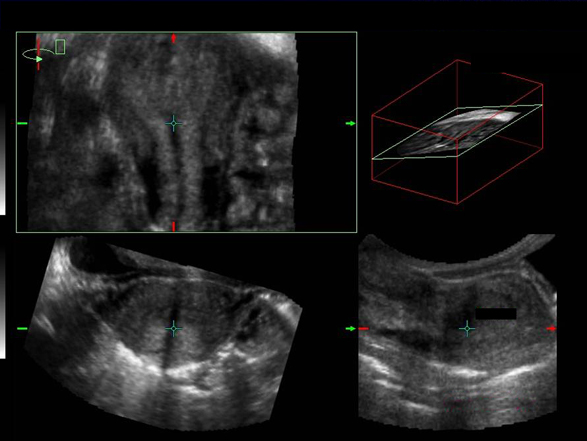 Icono Echographie Des Malformations Ut Rines