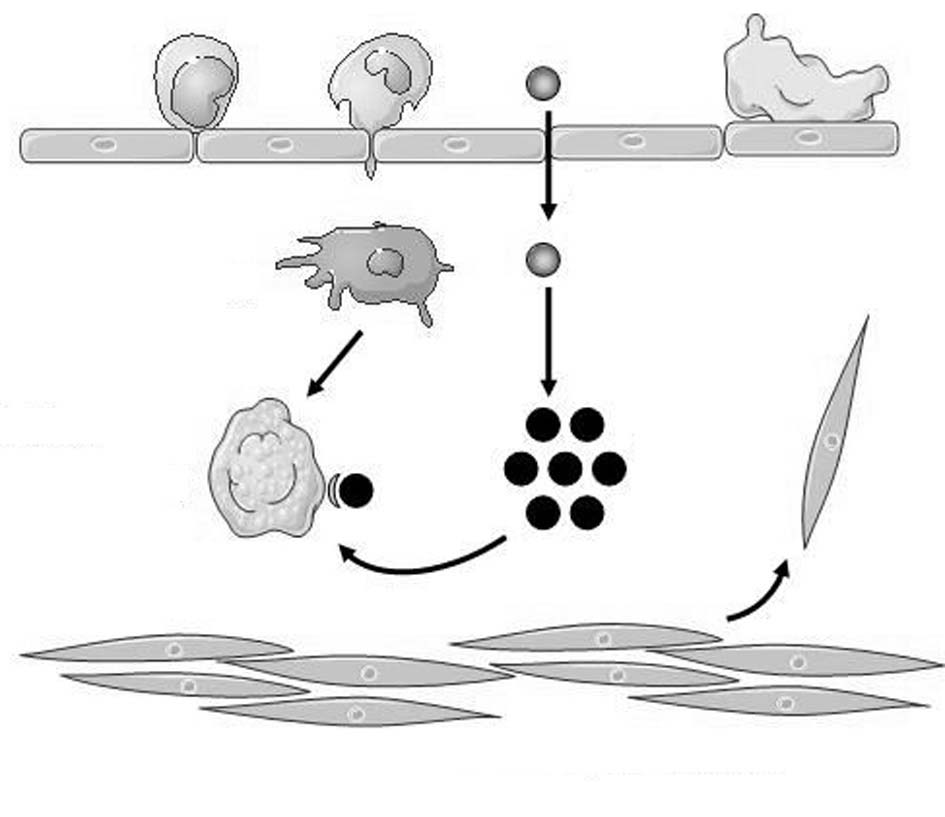 Fig. 1.1. Physiopathologie succincte de l’athéromatose