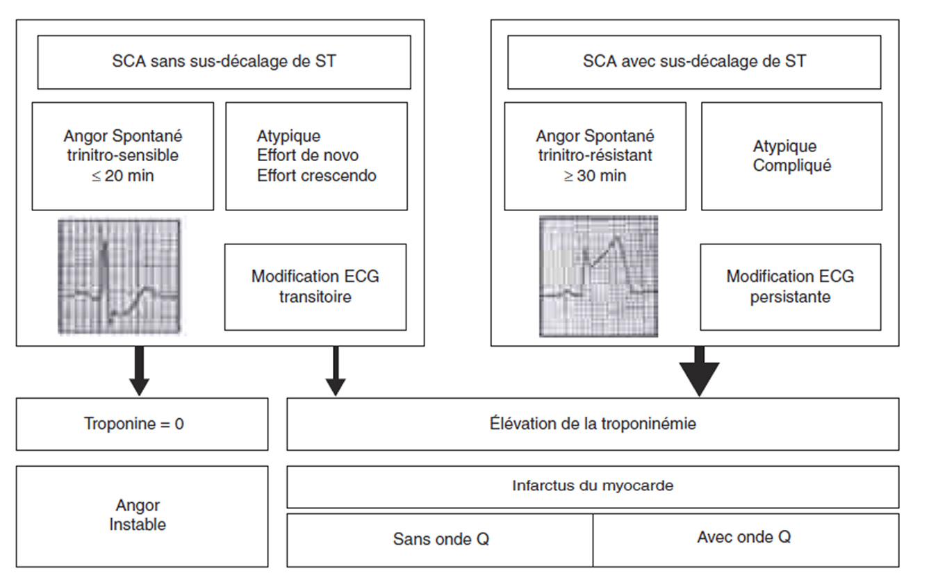 Figure 5. Classification des syndromes coronaires