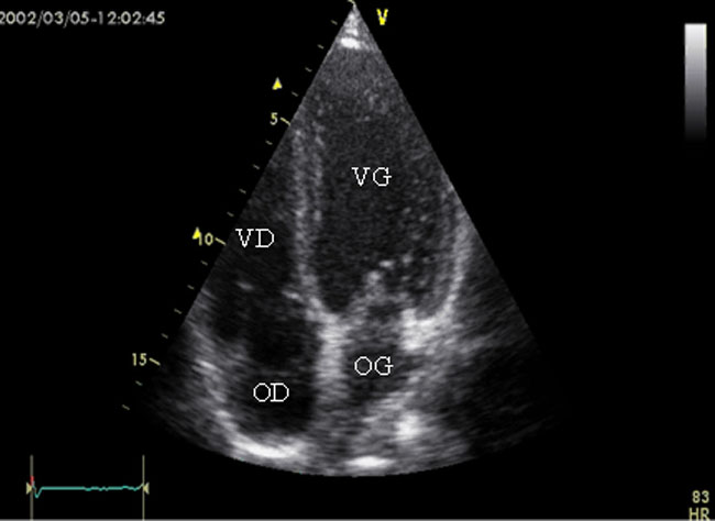 Figure 18 : Echographie bidimensionnelle