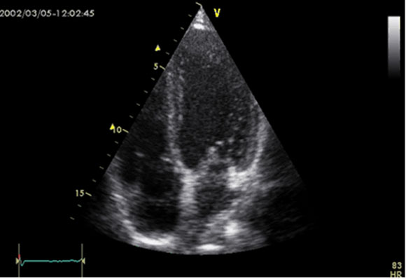 Figure 19 : Echographie bidimensionnelle