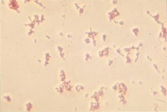 Lactobacillus, Coloration de Gram