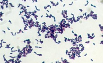 Propionibacterium, coloration de Gram