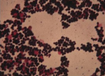 Staphylococcus, Coloration de Gram : colonies en forme de grappe de raisin