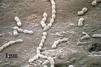 Streptococcus, groupements en paire ou chaînette