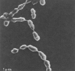 Peptostreptococcus anaerobius, aspect des cellules en microscopie électronique à balayage