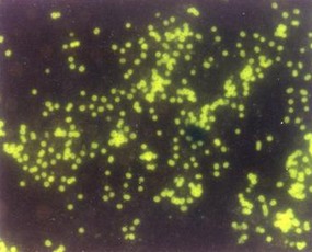 Porphyromonas gingivalis en microscopie immuno-fluorescence