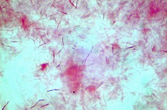 Fusobacterium : coloration de Gram