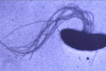 Selenemonas sputigena, aspect d’une cellule en microscopie électronique en transmission