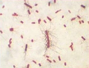 Les bactéries avec flagelles