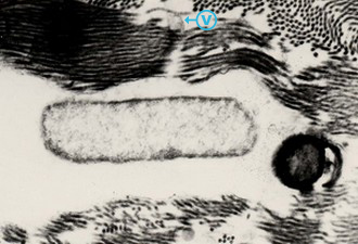 Action des vésicules membranaires dans le tissu conjonctif : passage d’une vésicule à travers un faisceau de fibres de collagène