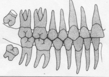 Phase de denture adulte jeune stable (Schour et Massler d'après Lautrou)